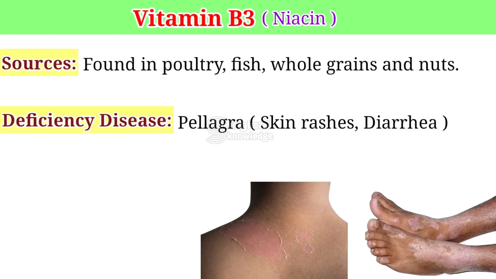 מקורות ויטמין B3