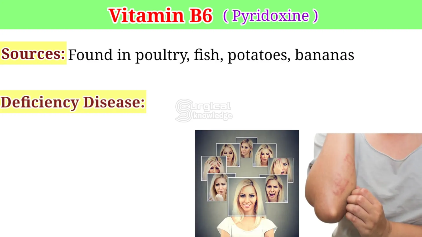 מקורות ויטמין B6