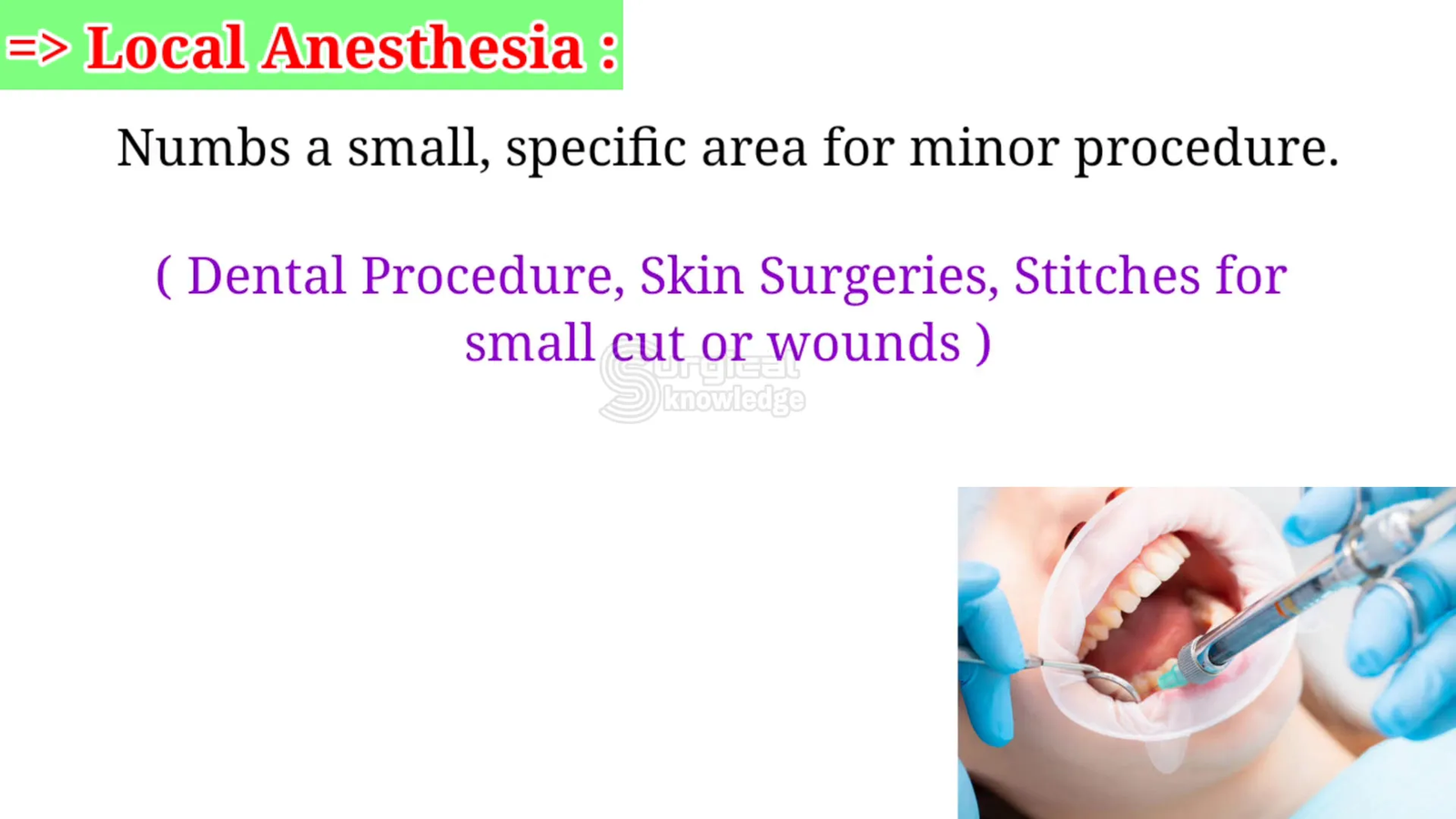 הרדמה מקומית