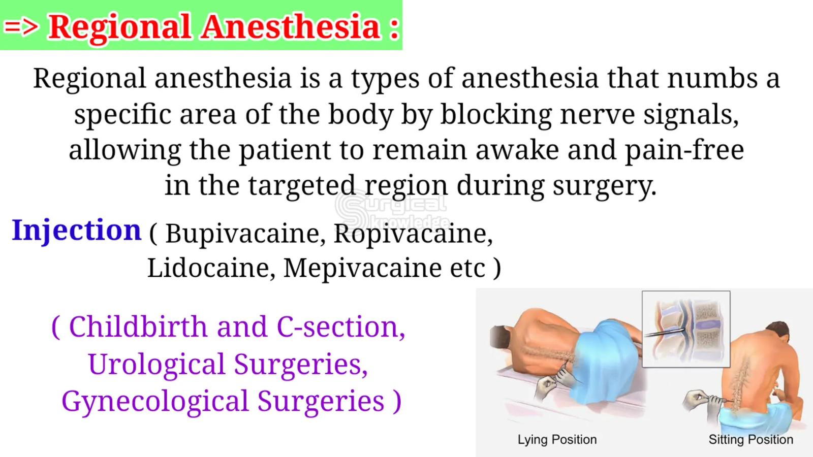 סוגי ניתוחים שבהם משתמשים בהרדמה אזורית